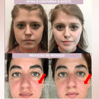 V-Mask – Máscara de Contorno Facial e Redutor de Papada